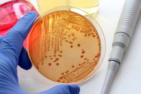 аэробные и анаэробные бактерии